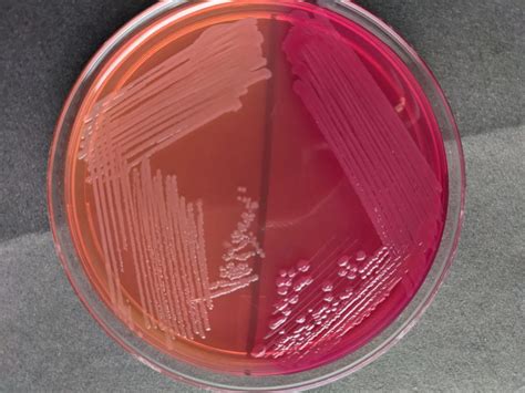 MacConkey agar .